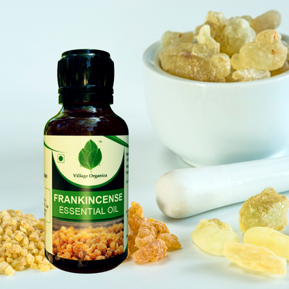 Frankincense Essential Oil.